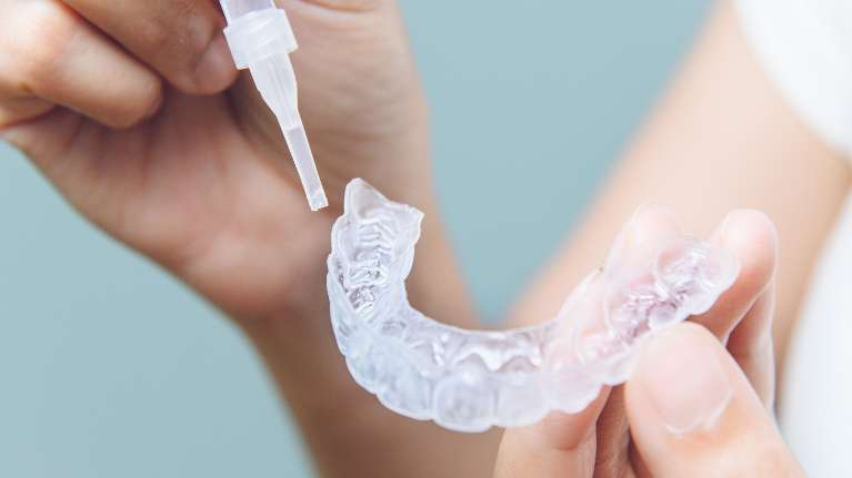 Teeth whitening tray | dentist pacifica ca