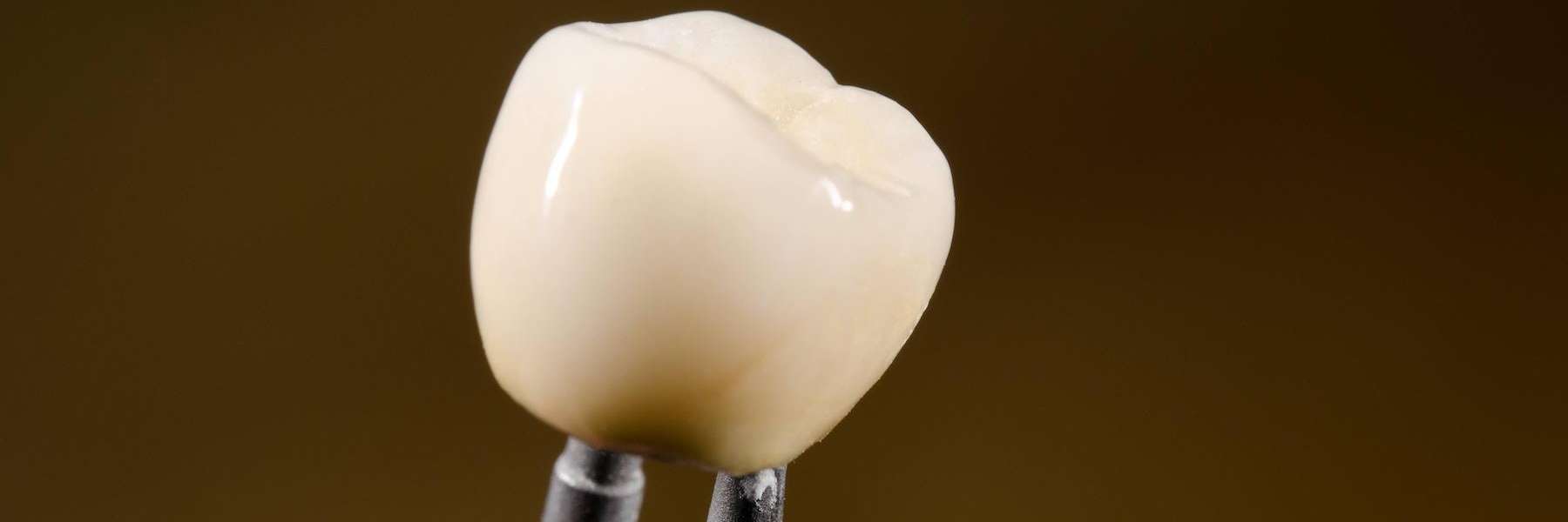 An image of a dental crown in Pacifica, CA