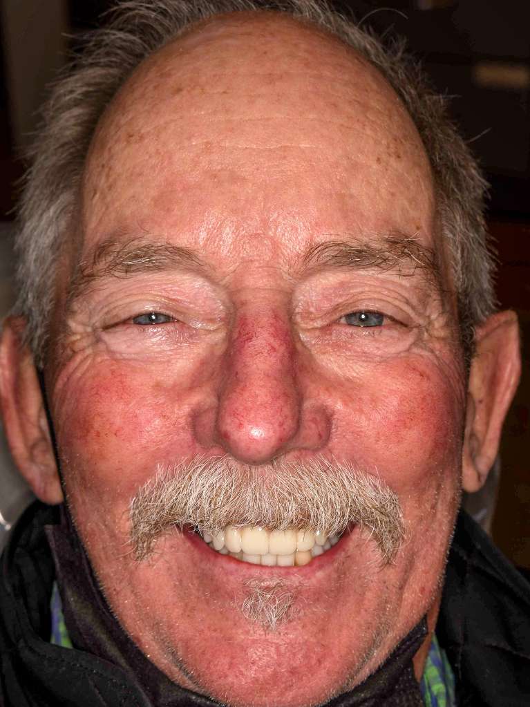 Bill, a patient at Nederland Family Dental