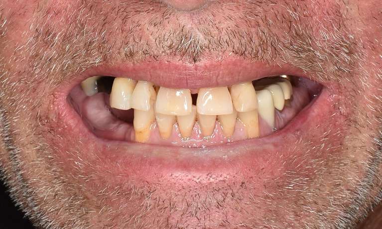 A-Life-Changed-Before-Image