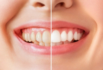 Before and after cosmetic treatment