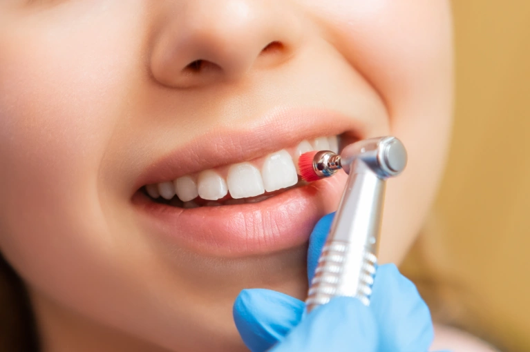 A patient's teeth is being cleaned by a dentist
