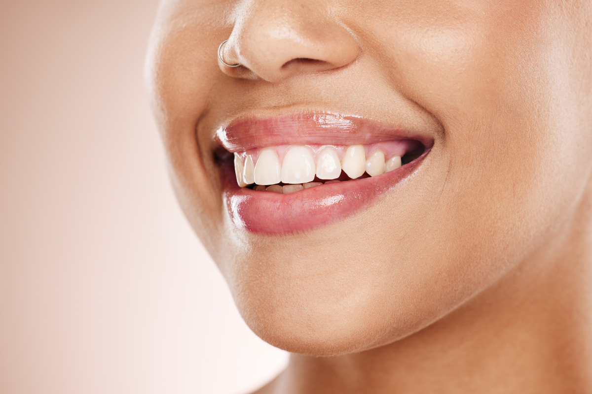 Close-up of a woman's bright white smile showing healthy teeth and natural gum line.