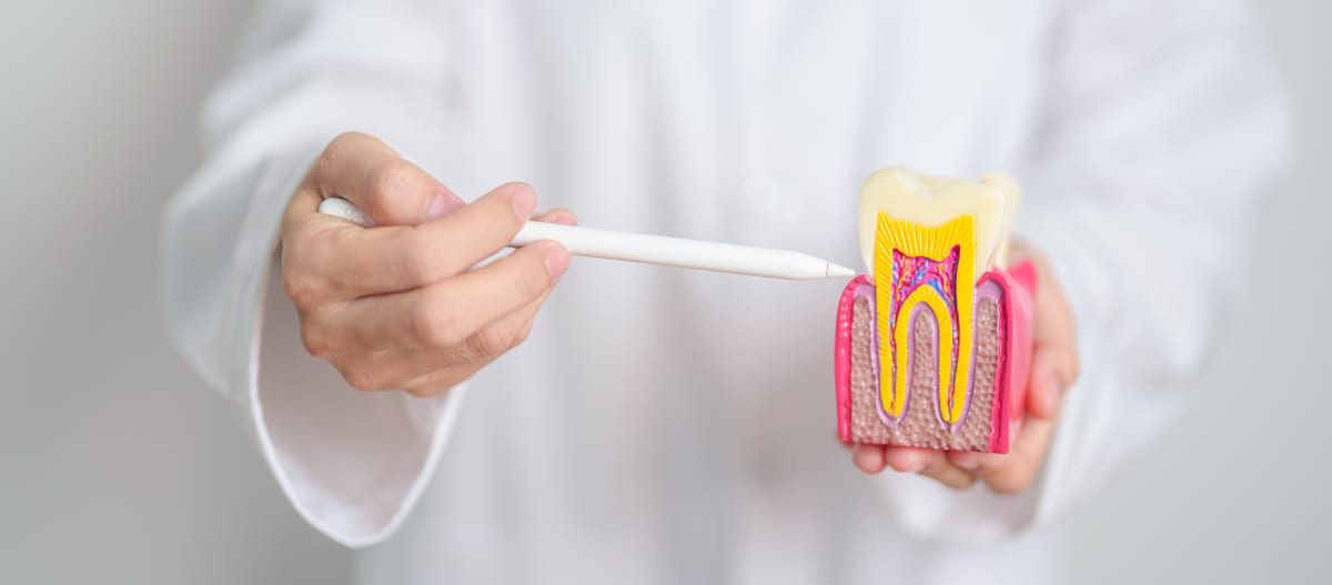 Root Canal Treatment in Pacifica