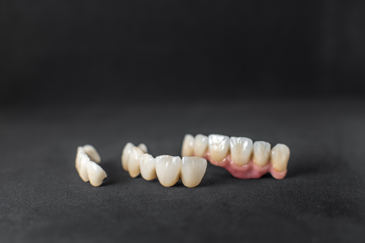 Protect Damaged Teeth With Dental Crowns